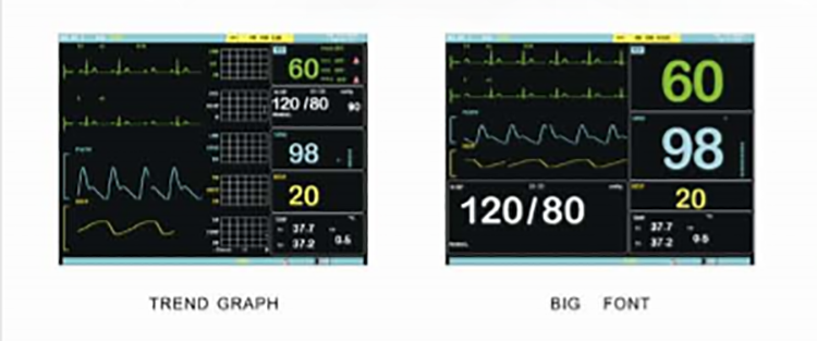 CE Certificated medical equipment TR-900B 12 inch color TPT LCD display patient monitor for sale